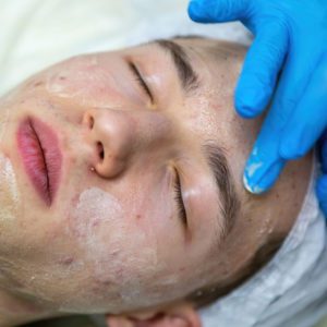 Teenage boy getting an acne treatment from Deja Vu Med Spa and Salon.