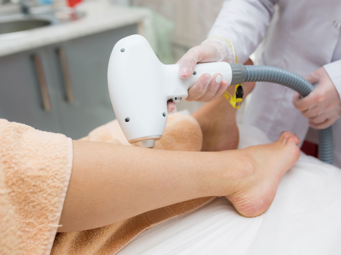 Close up of a woman's leg getting laser treatment from Deja Vu Med Spa and Salon.
