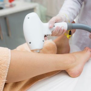 Close up of a woman's leg getting laser treatment from Deja Vu Med Spa and Salon.