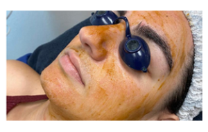 Lady receiving a European facial Therapeutic Pumpkin Mask at Deja Vu Med Spa and Salon