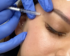 A woman recieving Botox.
