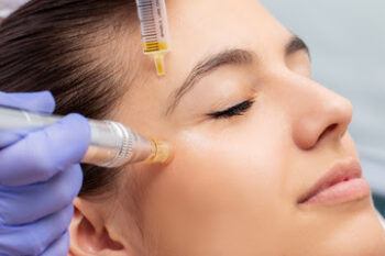 Woman receiving a Platelet Rich Plasma (PRP) Therapy.