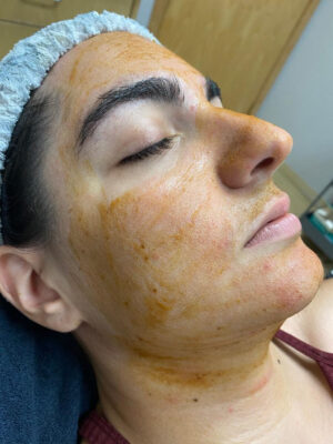 Woman receiving a pumpkin facial.